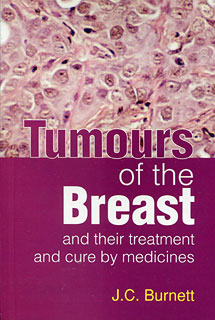 James Compton Burnett: Tumours of the Breast
