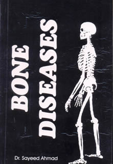 Sayeed Ahmad: Bone disease