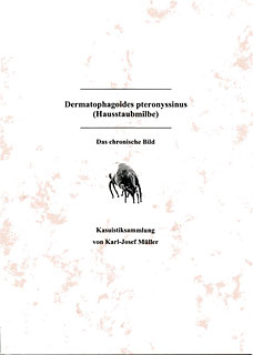 Karl-Josef Müller: Dermatophagoides pteronyssinus  (Hausstaubmilbe)