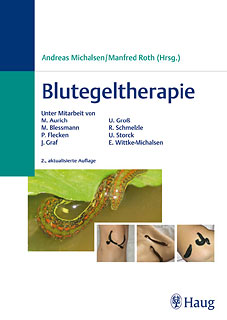 Andreas Michalsen / Manfred Roth: Blutegeltherapie