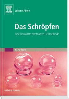 Johann Abele: Das Schröpfen