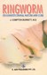 Ringworm - its Constitutional Nature and Cure