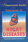 Illustrated Guide to the Treatment of Heart Diseases / Harbaris Singh Khaneja